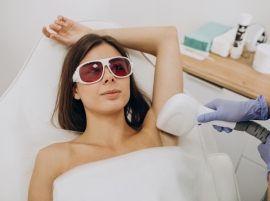 Laser hair removal